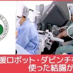 Thumbnail of related posts 172