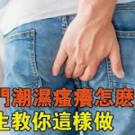 Thumbnail of related posts 018