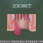 Thumbnail of related posts 005