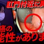 Thumbnail of related posts 000