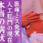 Thumbnail of related posts 171