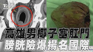 Thumbnail of post image 014